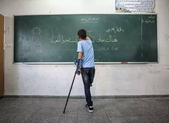 صورة للطفل محمد بعد الاصابة وبتر ساقه