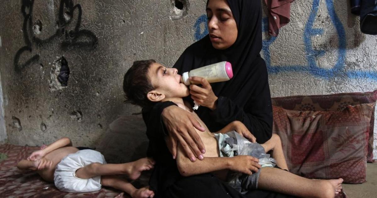 تفشي سوء التغذية الحاد بين أطفال غزة يهدد حياة الآلاف