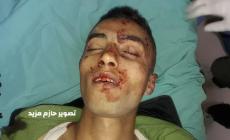 الشهيد لم تعرف هويته بعد