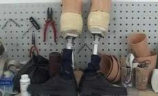 أطراف صناعية 