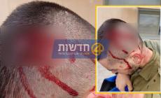 صورة نشرها الاعلام العبري لجندي مصاب خلال الشجار
