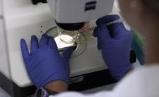 البكتيريا يمكن أن تسبب التهابا رئويا حادا