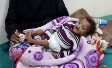 يمنية في مأرب تحمل طفلها الذي يعاني من نقص التغذية