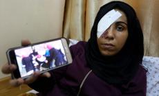 شاهد| هكذا استهدف قناص #عين_مي