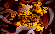 صور بالمجهر الإلكتروني من خلال المسح الضوئي لفيروس كورونا والتي نشرها باحثون أميركيون