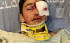 الطفل المصاب