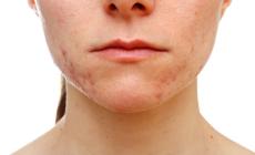 صورة "أرشيفية"