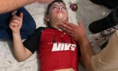 من الإصابات