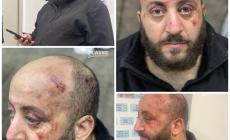 جانب من آثار الاعتداء على العائلة