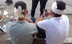 صورة لطالب جرى الاعتداء عليهم من قبل بلطجية أمن السلطة