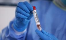 قطاع غزة دخل في الموجة الخامسة من جائحة كوفيد 19 من نوع BA5