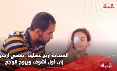 المصابة أريج عسلية نفسي ارجع زي أول أشوف ويروح الوجع