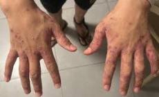 التعذيب بالجرب: سياسة الاعتقال الجديدة التي منعت إياد من احتضان أمه