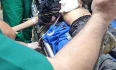 استشهاد الطفل أيمن نصار الهيموني متأثرًا بإصابته في الخليل