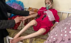 تفاقم الأزمة الإنسانية في غزة: أكثر من 65 ألف حالة سوء تغذية حاد بين الأطفال