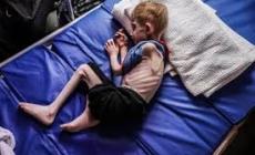 طبيب استشاري للرسالة: هذه المخاطر تهدّد أطفال غزة