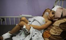 مستشفى العيون في غزة على حافة الانهيار بسبب نقص حاد في المواد الطبية