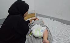 هاني… رضيع خرج من حضن أمه مبتور القدم