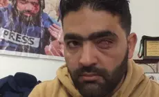 مركز حماية الصحفيين يدين تجديد الاعتقال الإداري للصحفي الجريح معاذ عمارنة