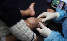 أطباء دوليون: جروح المدنيين في غزة الأسوأ على الإطلاق