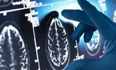 وزارة الصحة بغزة تعيد تشغيل أجهزة التصوير الطبي الملون