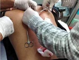 أحد المصابين