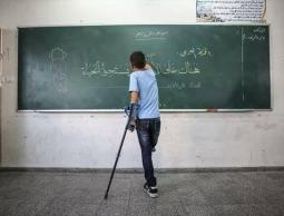 صورة للطفل محمد بعد الاصابة وبتر ساقه