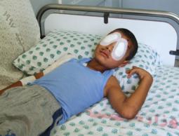 الطقل خميس أبو عرب بعد اصابته بجسم مشبوه