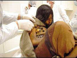 الفتاة المتجمدة منذ 500 عام 