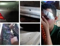 صورة لاعتداء الاحتلال