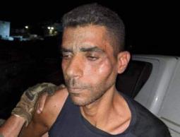 نقل الأسير زكريا الزبيدي لمستشفى 