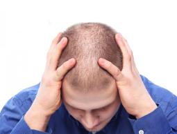 كشفت دراسية حديثة نقلتها دويتشه فيله أن مادة كيميائية هي مفتاح التحكم في توقيت انقسام بصيلات الشعر