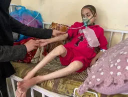 تفاقم الأزمة الإنسانية في غزة: أكثر من 65 ألف حالة سوء تغذية حاد بين الأطفال