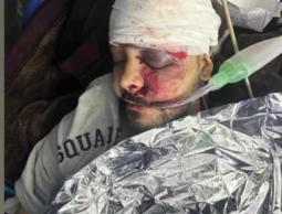 الشاب مؤمن أبو عمشة من غرفة العناية المركزة في مستشفى المعمداني