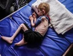 طبيب استشاري للرسالة: هذه المخاطر تهدّد أطفال غزة