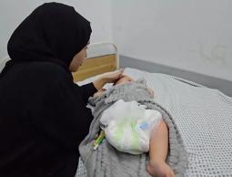 هاني… رضيع خرج من حضن أمه مبتور القدم