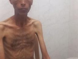 عالق بين الألم والجوع… فيصل أبو ضاهر يبحث عن منقذ لحياته 