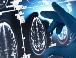 وزارة الصحة بغزة تعيد تشغيل أجهزة التصوير الطبي الملون