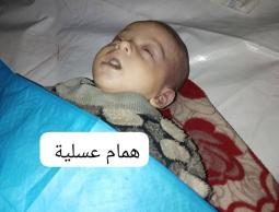 استشهاد رضيعة جراء البرد القارس في غزة