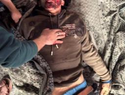 ارتقاء المواطن فهمي قدوم برصاص الاحتلال شمال قطاع غزة.