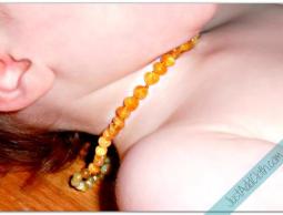 قلائد العنبر وصحة الأطفال