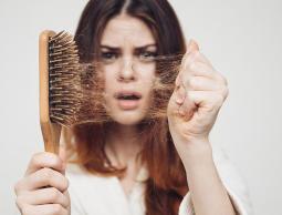تساقط الشعر.. الأسباب والعلاج