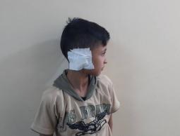 الطفل الذي فقد أذنه