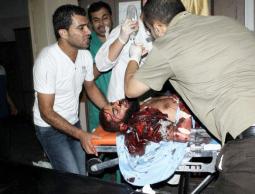 أحد مصابي العدوان الإسرائيلي على قطاع غزة