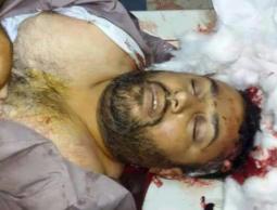 ﻣﺼﻄﻔﻲ ﺃﻳﻮﺏ ﺍﻟﺠﺒﻮﺭ &rlm;(30 ﻋﺎما)