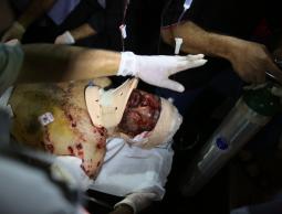 أحد شهداء الإعتداء الأخير