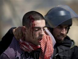 شاب تم الإعتداء عليه من قبل قوات الإحتلال