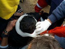 صورة للمصاب