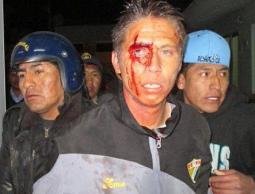 مارتن دالاورسو