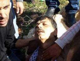 لحظة الإصابة